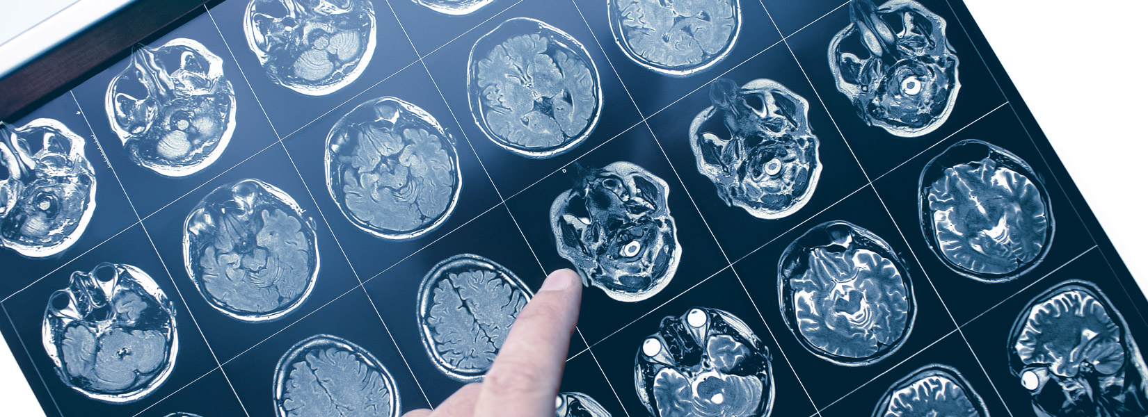 Neuro-Optometry in Centerville