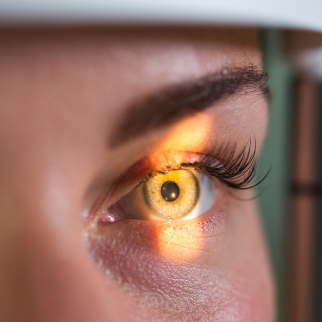 Vision Therapy in Centerville
